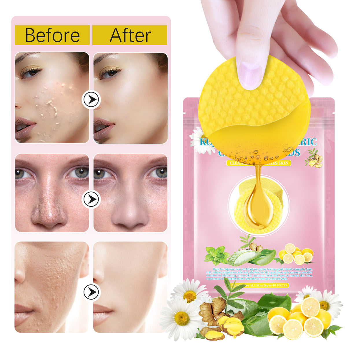 Turmeric Kojic Acid Cleansing Pad Cleansing And Oil Controlling